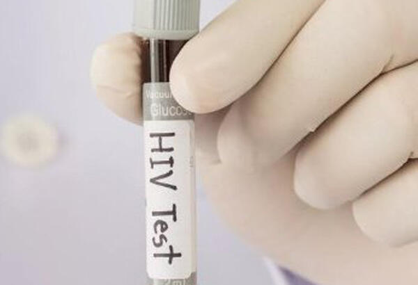 По информации Могилевского областного центра гигиены, эпидемиологии и общественного здоровья, в апреле в нашей области зарегистрировано 12 новых случаев ВИЧ-инфекции.